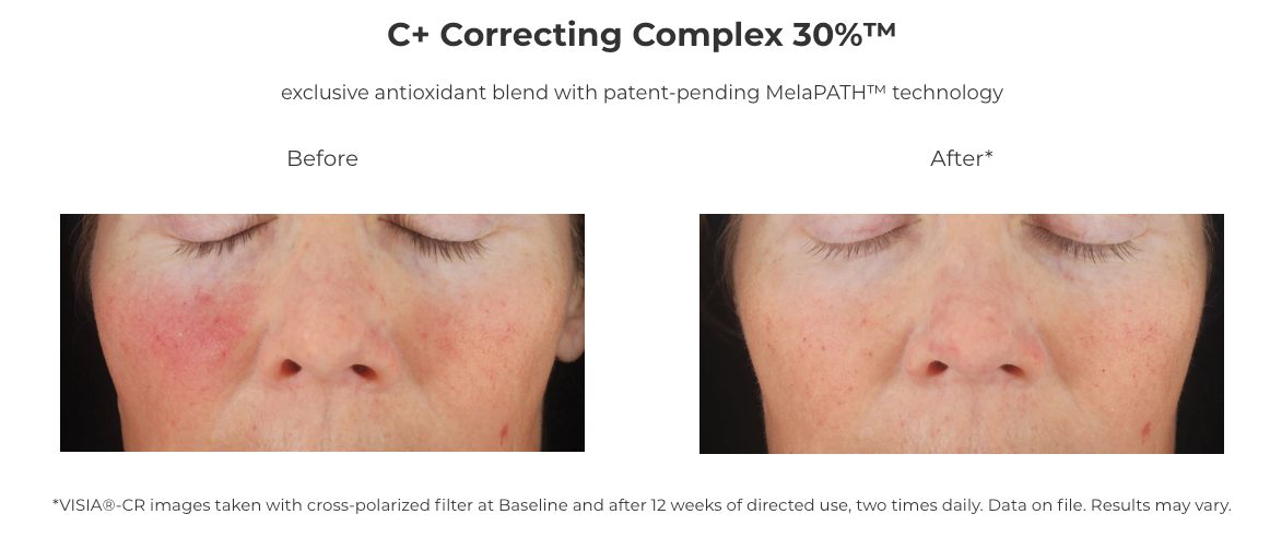 Revision Skincare C+ Correcting Complex 30%