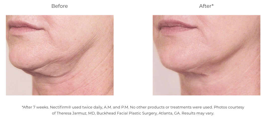 Revision Skincare Nectifirm Advanced