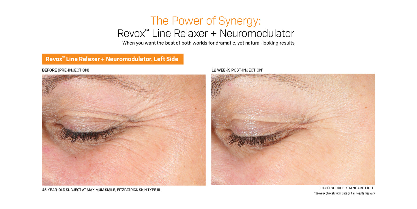 Revision Skincare Revox Line Relaxer
