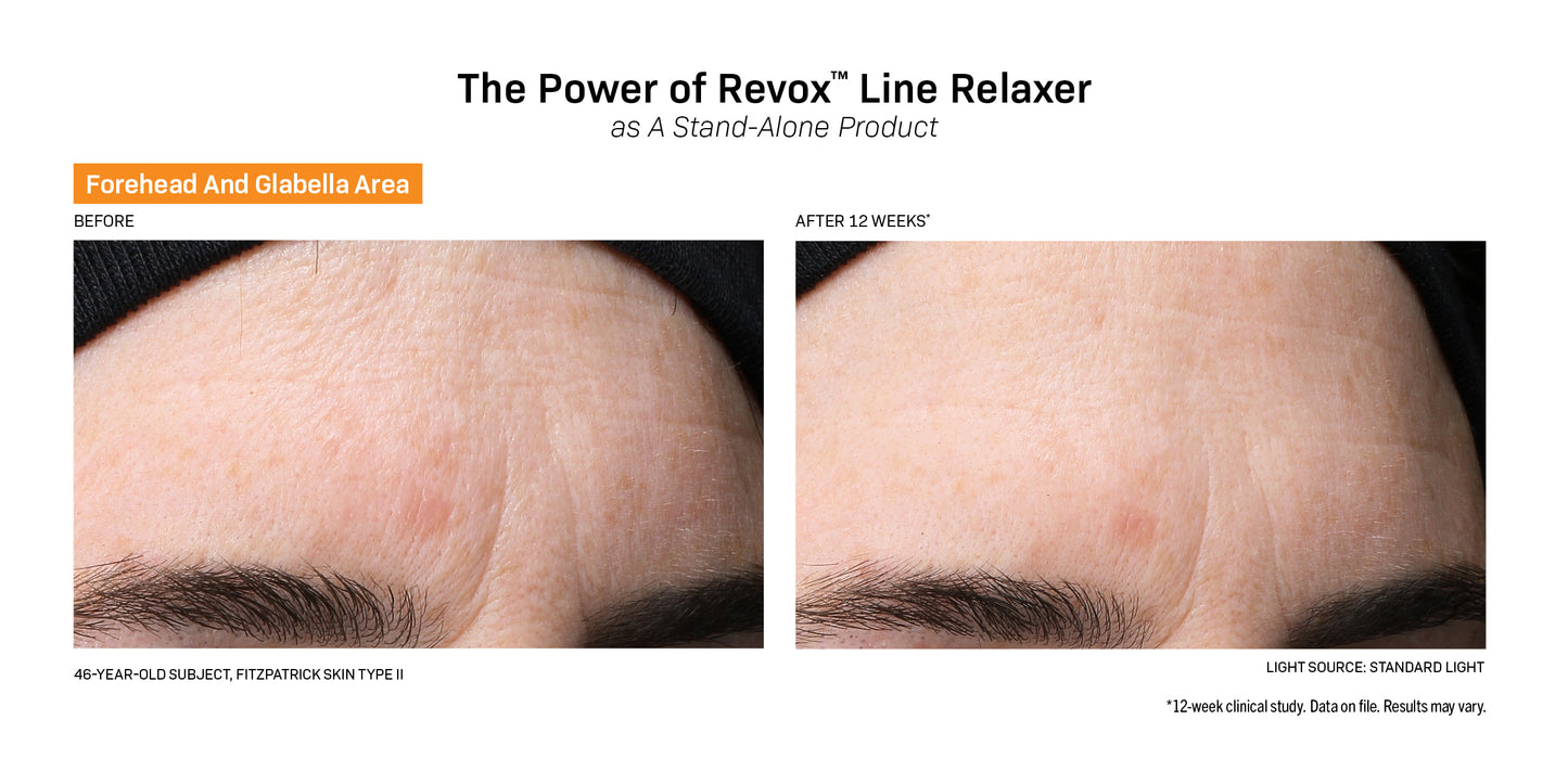 Revision Skincare Revox Line Relaxer